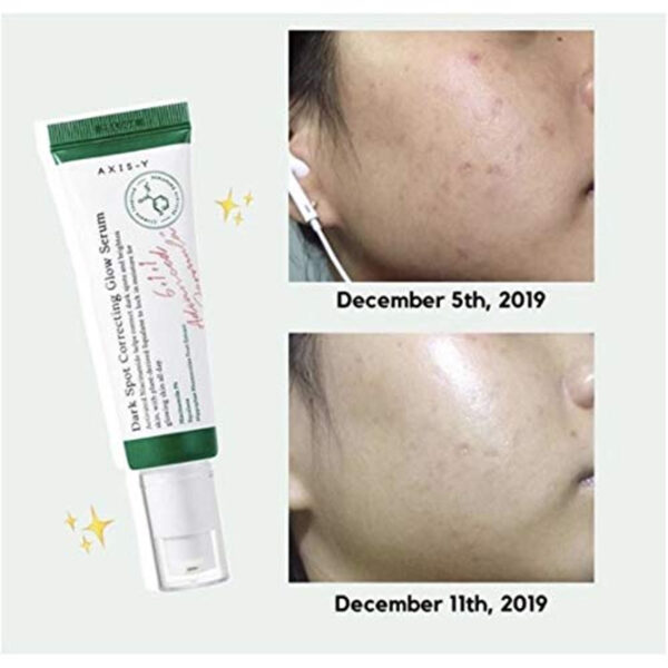 AXIS-Y Dark Spot  Serum - Image 2